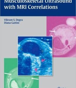 Musculoskeletal Ultrasound with MRI Correlations (ORIGINAL PDF from Publisher)