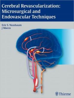 Cerebral Revascularization: Microsurgical and Endovascular Techniques (ORIGINAL PDF from Publisher)