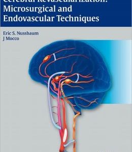 Cerebral Revascularization: Microsurgical and Endovascular Techniques (ORIGINAL PDF from Publisher)