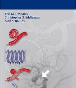 Handbook of Neuroendovascular Surgery