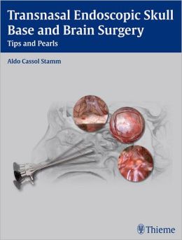 Transnasal Endoscopic Skull Base and Brain Surgery: Tips and Pearls (ORIGINAL PDF from Publisher)