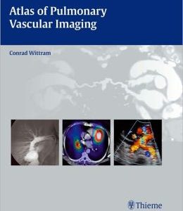 Atlas of Pulmonary Vascular Imaging: A Multimodality Approach