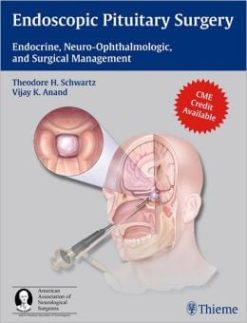 Endoscopic Pituitary Surgery: Endocrine, Neuro-Ophthalmologic and Surgical Management (Original PDF from Publisher)