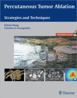 Percutaneous Tumor Ablation: Strategies and Techniques (ORIGINAL PDF from Publisher)