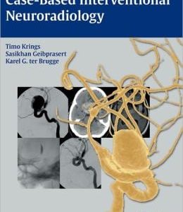 Case-Based Interventional Neuroradiology
