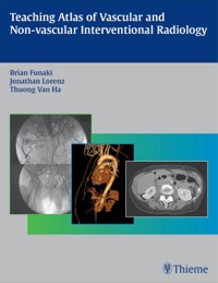 Teaching Atlas of Vascular and Non-Vascular Interventional Radiology (Original PDF from Publisher)