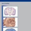 Neurosurgical Intensive Care (Original PDF from Publisher)
