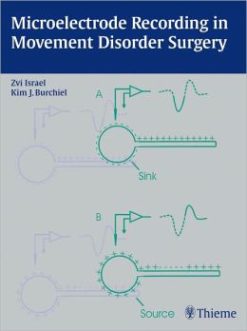 Microelectrode Recording in Movement Disorder Surgery