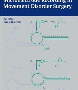 Microelectrode Recording in Movement Disorder Surgery