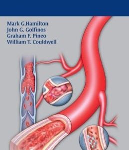 Handbook of Bleeding and Coagulation for Neurosurgery