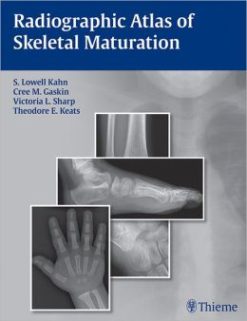 Radiographic Atlas of Skeletal Maturation (ORIGINAL PDF from Publisher)