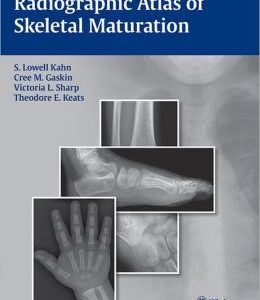 Radiographic Atlas of Skeletal Maturation (ORIGINAL PDF from Publisher)