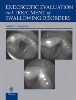 Endoscopic Evaluation and Treatment of Swallowing Disorders