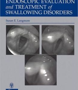 Endoscopic Evaluation and Treatment of Swallowing Disorders
