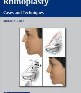 Rhinoplasty: Cases and Techniques (ORIGINAL PDF from Publisher)