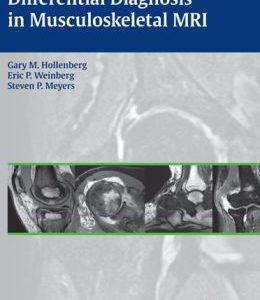 Differential Diagnosis in Musculoskeletal MRI