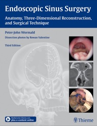 Endoscopic Sinus Surgery, 3rd Edition (Original PDF from Publisher)