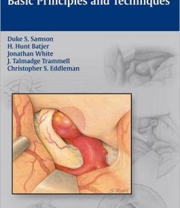 Intracranial Aneurysm Surgery: Basic Principles and Techniques