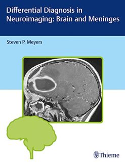 Differential Diagnosis in Neuroimaging: Brain and Meninges (PDF)