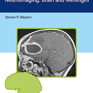 Differential Diagnosis in Neuroimaging: Brain and Meninges (PDF)
