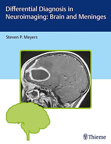 Differential Diagnosis in Neuroimaging: Brain and Meninges (PDF)