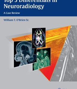 Top 3 Differentials in Neuroradiology (EPUB)