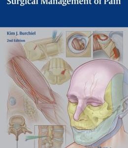Surgical Management of Pain, 2nd Edition