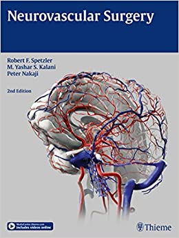 Neurovascular Surgery, 2nd edition (Videos Only, Well Organized)