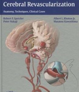 Color Atlas of Cerebral Revascularization: Anatomy, Techniques, Clinical Cases: Anatomy, Techniques, Clinical Cases (ORIGINAL PDF from Publisher)