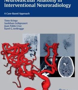 Neurovascular Anatomy in Interventional Neuroradiology: A Case-Based Approach