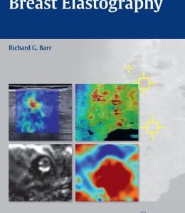 Breast Elastography (ORIGINAL PDF from Publisher)