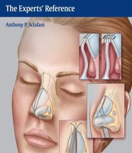 Rhinoplasty: The Experts’ Reference