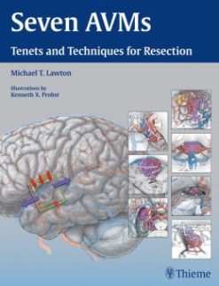 Seven AVMs: Tenets and Techniques for Resection (ORIGINAL PDF from Publisher)
