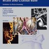 Vasculature of the Brain and Cranial Base (PDF)