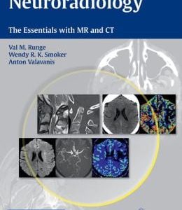 Neuroradiology: The Essentials with MR and CT