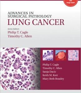 Advances in Surgical Pathology: Lung Cancer (ORIGINAL PDF from Publisher)