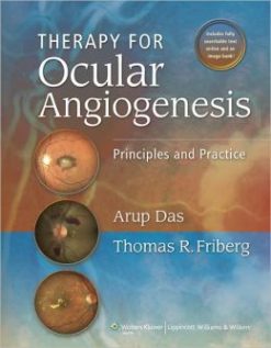 Therapy for Ocular Angiogenesis: Principles and Practice (Original PDF from Publisher)