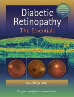 Diabetic Retinopathy: The Essentials (Original PDF from Publisher)