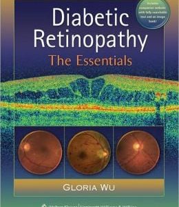 Diabetic Retinopathy: The Essentials (Original PDF from Publisher)