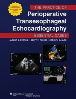 The Practice of Perioperative Transesophageal Echocardiography: Essential Cases (EPUB)