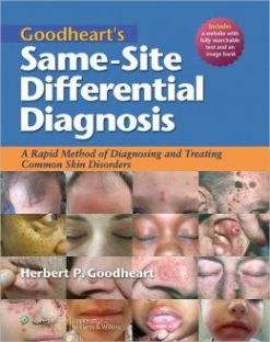 Goodheart’s Same-Site Differential Diagnosis: A Rapid Method of Diagnosing and Treating Common Skin Disorders (Original PDF from Publisher)