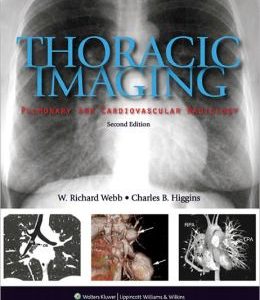 Thoracic Imaging: Pulmonary and Cardiovascular Radiology, 2nd Edition (ORIGINAL PDF from Publisher)