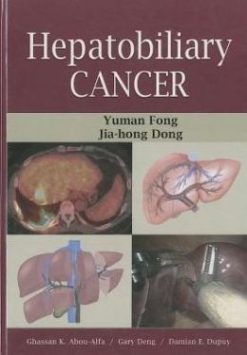 Hepatobiliary Cancer