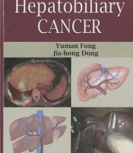 Hepatobiliary Cancer