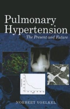 Pulmonary Hypertension: The Present and Future (ORIGINAL PDF from Publisher)