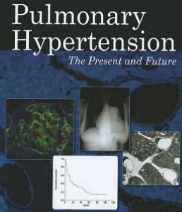 Pulmonary Hypertension: The Present and Future (ORIGINAL PDF from Publisher)