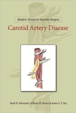 Modern Trends in Vascular Surgery: Carotid Artery Disease (Original PDF from Publisher)