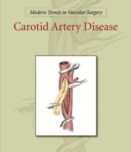 Modern Trends in Vascular Surgery: Carotid Artery Disease (Original PDF from Publisher)