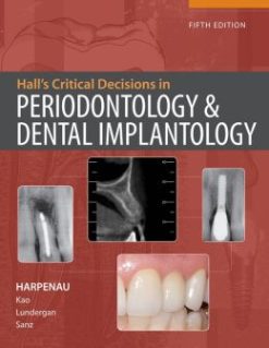 Hall’s Critical Decisions in Periodontology, 5th Edition