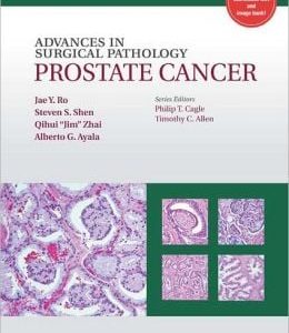 Advances in Surgical Pathology: Prostate Cancer (ORIGINAL PDF from Publisher)